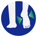 DIABETIC NEUROPATHY
